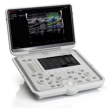 УЗИ аппарат Esaote MyLab Omega