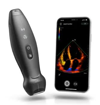 УЗИ аппарат Mindray TEAir