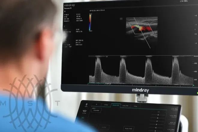 УЗИ аппарат Mindray Resona i9