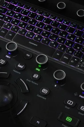 Ультразвуковая система GE Versana Premier Black