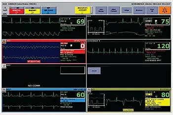 GE Carescape станция центрального мониторирования