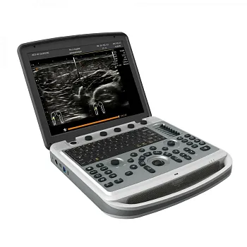 УЗИ аппарат Chison SonoTouch 80 Pro портативный