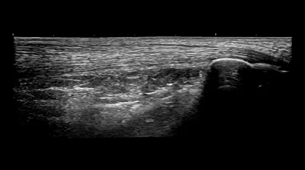 Клинические изображения GE HealthCare Versana Balance R2 УЗИ аппарат